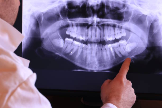 Best Walk-In Emergency Dentist in Brockway, PA